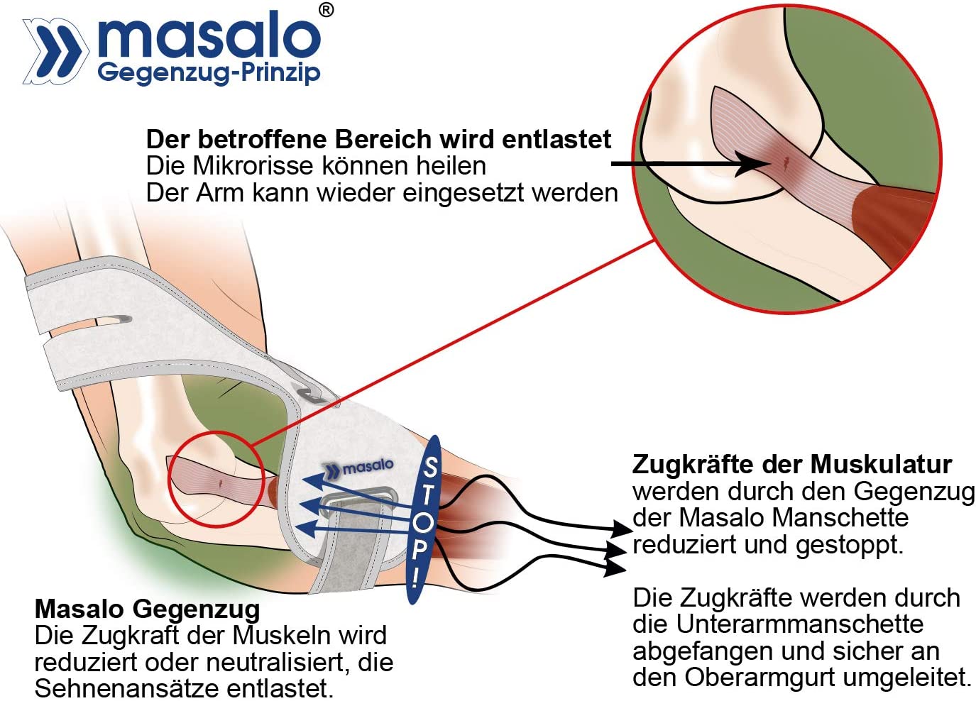71L7 glVi1L. AC SL1400
